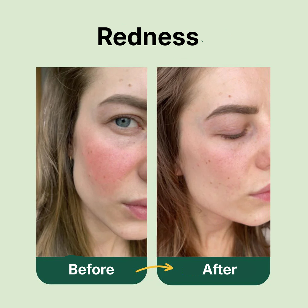 Silicone Photon Rejuvenation Mask